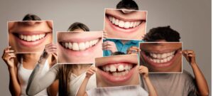 pictures of teeth with fluoride use