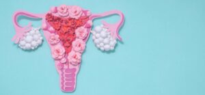 Cure PCOS naturally treatment
