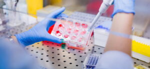 stem cells treat covid